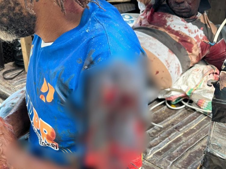 Korban dievakuasi ke RSUD Nabire untuk penanganan Medis. (Foto: Istimewa)