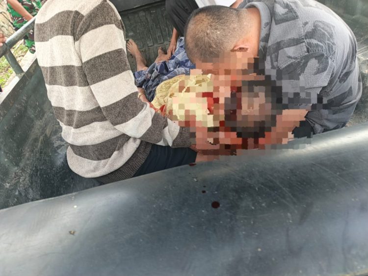 Korban diketahui bernama Mappe (63) alami kecelakaan Lalu Lintas di Karubaga. (Foto: Istimewa)