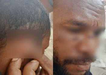 Terduga Pelaku Pembuangan Bayi di BTN Moria Berhasil Diamankan Polisi