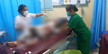 Tragis, Remaja Putri di Sentani Meninggal Dunia Usai Dibakar Ibu Tiri