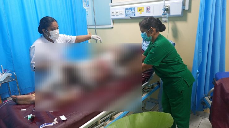Tragis, Remaja Putri di Sentani Meninggal Dunia Usai Dibakar Ibu Tiri